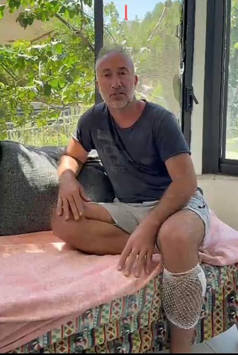 Yürüyüş yaparken köpek saldırısında yaralandı